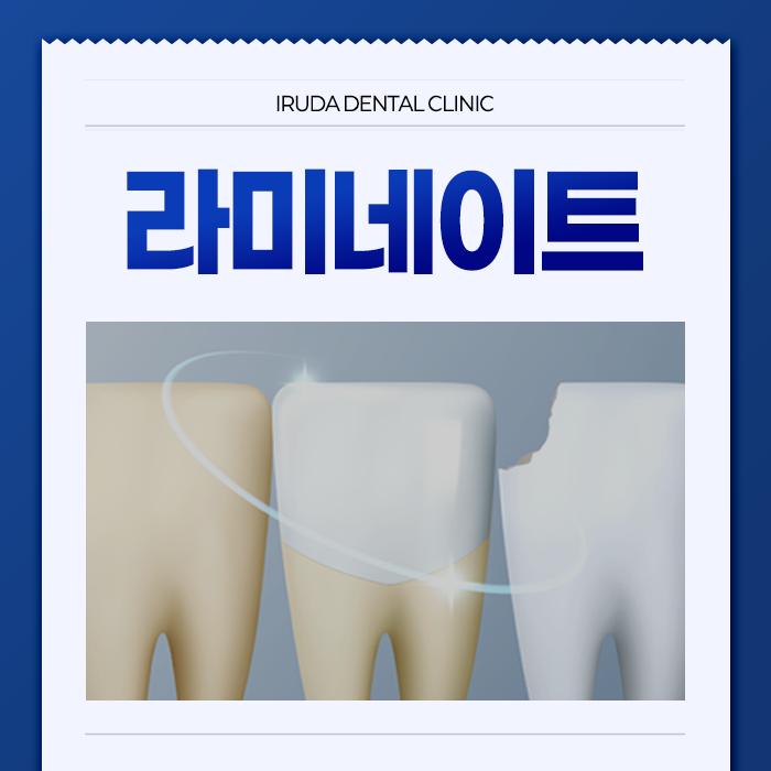 창원 라미네이트 추천 이루다치과